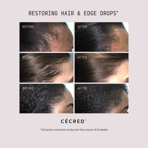 Restoring Hair & Edge Drops | CÉCRED